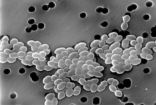 Bacterias. Imagen: Janice Haney Carr. Fuente: Wikimedia Commons.
