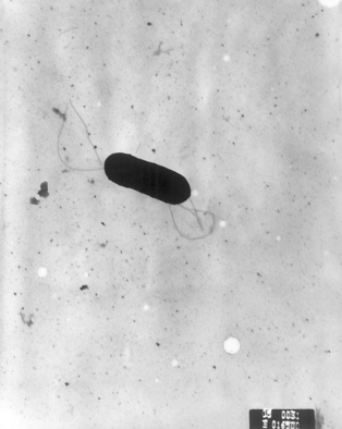 La bacteria Listeria monocytogenes, al microscopio. Fuente: Wikipedia.