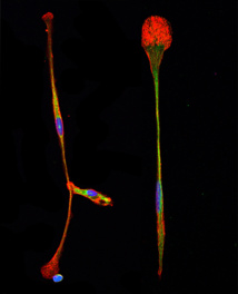 Los científicos del TSRI han encontrado una forma sencilla de convertir células madre de médula ósea directamente en células del cerebro, tales como los que se muestran en esta imagen. Imagen cortesía del laboratorio de Lerner, en The Scripps Research Institute.