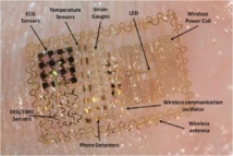 Tatuaje para la piel con electrodos y otros elementos incorporados. Fuente: Neural Interaction Lab (UCSD).