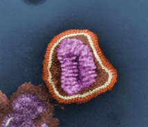 Partícula viral o «virión» del virus de la gripe. Imagen: Cynthia Goldsmith. Fuente: CDC.
