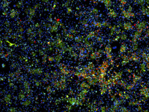 En la imagen, las manchas verdes identifican a las células del hígado, y las rojas a las células que se están dividiendo activamente. Imagen: Shan et. Al. Nature Chemical Biology. Fuente: MIT.