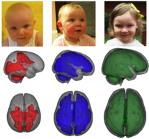 Las imágenes de resonancia magnética tomadas mientras los niños estaban dormidos muestran diferencias de desarrollo en zonas clave del cerebro entre niños amamantados y no amamantados.  Imagen: Advanced Baby Imaging Lab. Fuente: Universidad de Brown.