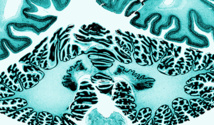Una de las  7.400 secciones del cerebro escaneadas para crear el atlas 3D. Imagen: Claude LePage. Fuente: AAAS.