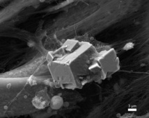 'Hueso artificial', o mineralización de la matriz extracelular obtenida por los científicos granadinos gracias a su patente. Fuente. UGR.