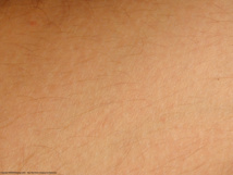 Piel humana. Fuente: www.mayang.com.