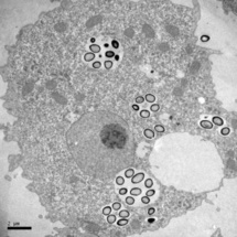 Imagen del microscopio electrónico de una ameba Acanthamoeba repleta de Pandoravirus. Imagen: Chantal Abergel/Jean-Michel Claverie. Fuente: SINC.
