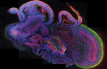 Sección de un 'organoide cerebral' con regiones diferenciadas. En rojo se observan células madre neuronales y en verde, neuronas. / Madeline A. Lancaster . IMBA.