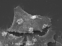 Micrografía electrónica de barrido de las células HeLa infectadas in vitro con bacterias atenuadas EPEC. Fuente: CNB-CSIC.