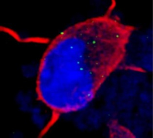 Los puntos fluorescentes en el interior de esta neurona indican la presencia de ARN tóxico. Fuente: Neuron.