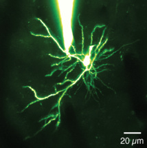 Esto es una dendrita de una neurona del cerebro. El objeto brillante de la parte superior es una pipeta unida a una dendrita del cerebro de un ratón. La pipeta permitió a los investigadores medir la actividad eléctrica en las dendritas. Fuente: University of North Carolina School of Medicine.