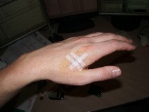 Implante RFID en la mano de una persona