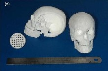 Modelos de prótesis fabricadas con una impresora