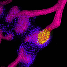 Primordio de riñón obtenido en el laboratorio de Juan Carlos Izpisúa a partir de células madre humanas. En amarillo se marcan las células humanas que se han diferenciado a células precursoras del sistema colector renal. Fuente: CMRB.