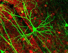 Neuronas. Fuente: Wikipedia.