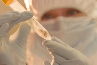 Los investigadores obtuvieron el ADN bacteriano de los dientes de dos víctimas de la peste. Fuente: Universidad McMaster.