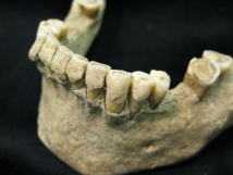 Placa dental fosilizada (cálculo) en dientes de un hombre de mediana edad del asentamiento medieval de Dalheim, Alemania. Imagen: Christina Warinner. Fuente: Universidad de York.