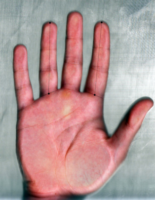 El ratio digital se obtiene al dividir la longitud del dedo índice entre la longitud del dedo anular de la misma mano. Fuente: UGR.