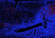 Una reprogramación química podría regenerar los nervios tras lesiones medulares Una reprogramación química podría regenerar los nervios tras lesiones medulares