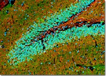 Descifrado el mecanismo cerebral del déjà-vu Descifrado el mecanismo cerebral del déjà-vu