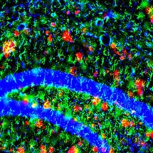 La placa amiloide, en rojo, en el cerebro de un ratón con Alzhéimer. Imagen: John Cirrito. Fuente: Universidad de Washington en St. Louis.