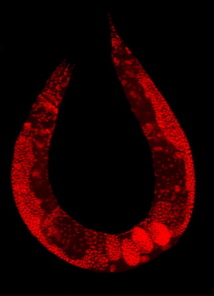 Caenorhabditis elegans. Imagen: PLOS ONE. Fuente: Wikpedia.