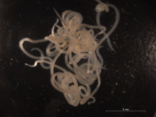 'Anisakis'. Fuente: CSIC.