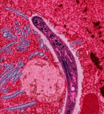 Parásito 'Plasmodium', que transmite la malaria a través de hembras de mosquitos. Fuente: Wikipedia.