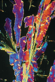 Cristales de propranolol. Sidney Moulds / Science Photo Library. The dana Foundation. Cristales de propranolol. Sidney Moulds / Science Photo Library. The dana Foundation.