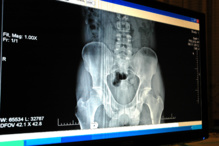 El sistema obtiene radiografías en cinco segundos. Fuente: AlphaGalileo.