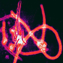 Micrografía electrónica de color realzado de partículas de virus del Ébola. Imagen: Thomas W. Geisbert, Boston University School of Medicine. Fuente: PLoS Pathogens.