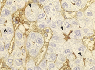 Células epiteliales de hígado. Fuente: CSIC.