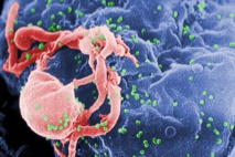 Viriones de VIH-1 (en verde) ensamblándose en la superficie de un linfocito. Imagen: C. Goldsmith. Fuente: CDC/Wikipedia.