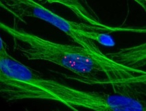 Fuente: CIQUS. Fuente: CIQUS.