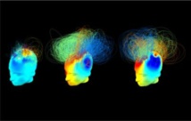 Redes cerebrales en dos pacientes en estado vegetativo (izquierda y centro) conductualmente iguales. Sin embargo, la actividad neuronal del paciente del centro cuando se le ordenó que se imaginara jugando al tenis es similar a la de la persona de la derecha (un adulto sano). Imagen: Srivas Chennu. Fuente: Universidad de Cambridge.