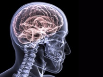 Fuente: MedUni Vienna. Fuente: MedUni Vienna.