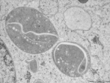 Cromoplastos (centro) en una célula. Fuente: UB. Cromoplastos (centro) en una célula. Fuente: UB.