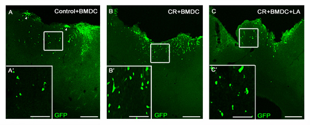 Implante de células madre de medula ósea procedente de ratones transgénicos para GFP en corteza cerebral tras lesión cerebral local, junto con una terapia farmacológica neuroprotectora. Fuente: Universidad CEU Cardenal Herrera/AlphaGalileo. Implante de células madre de medula ósea procedente de ratones transgénicos para GFP en corteza cerebral tras lesión cerebral local, junto con una terapia farmacológica neuroprotectora. Fuente: Universidad CEU Cardenal Herrera/AlphaGalileo.