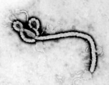 Estructura del virus del Ébola. Fuente: IBM
