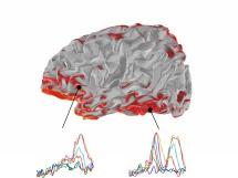Las dos etapas cerebrales de la percepción visual. CEA Las dos etapas cerebrales de la percepción visual. CEA