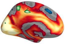 El rojo y el amarillo indican las áreas del cerebro más activas cuando las imágenes fueron valoradas como altamente estimulantes. El color verde indica las áreas que, específicamente, se volvieron más activas en las mujeres. Imagen: MCN. Fuente: Universidad de Basilea.