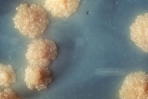 Acercamiento de un cultivo de Mycobacterium tuberculosis mostrando la morfología colonial del microorganismo. Imagen: PHIL. Fuente: Wikipedia.