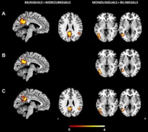 Áreas del cerebro activadas en bilingües y en monolingües. Fuente: UPF.