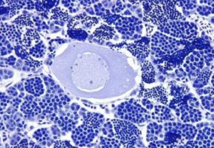 Testículo de un pez macho que contiene un huevo en gestación. Fuente: OSU. Testículo de un pez macho que contiene un huevo en gestación. Fuente: OSU.