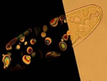 Gota de nano-ADN condensado, y dentro de ella gotas más pequeñas de su fase de cristal líquido (que se ven mediante luz polatizada en la parte izquierda de la foto). Las gotas de cristal líquido actúan como 'micro-reactores'. Imagen: Noel Clark. Fuente: Universidad de Colorado.