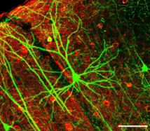 Neurona humana. Imagen: Wei-Chung Allen Lee et al. Fuente: Wikipedia.