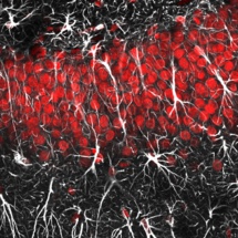 Astrocitos (en rojo) y neuronas (en blanco). Imagen: Jason Snyder. Fuente: Flickr/AlphaGalileo.