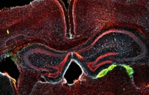 Tejido cerebral (azul y rojo), tres semanas después de inyectarle precursores neurales derivados de sangre (verde). Fuente: Universidad McMaster.