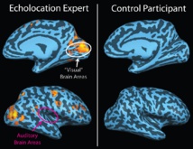 A la izquierda, actividad relacionada con el eco en el cerebro de un ecolocador ciego. No hay actividad evidente en el cerebro de una persona vidente (derecha) escuchando los mismos ecos. Imagen: "Brain image of blind echolocator", por Alan thistle. Fuente: Wikimedia Commons. A la izquierda, actividad relacionada con el eco en el cerebro de un ecolocador ciego. No hay actividad evidente en el cerebro de una persona vidente (derecha) escuchando los mismos ecos. Imagen: "Brain image of blind echolocator", por Alan thistle. Fuente: Wikimedia Commons.