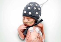 Los investigadores han encontrado que ciertos episodios, del tipo “lluvia de ideas”, se producen en el cerebro de los bebés muy prematuros y son fundamentales para la maduración cerebral. Imagen: Universidad de Helsinki. Fuente: AlphaGalileo.